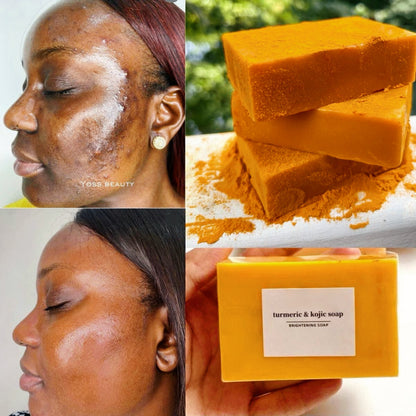 Savon pour le visage au curcuma pour une peau douce